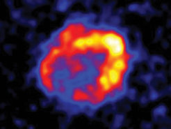 Mit Hilfe spezieller Teleskope können hoch energetische Gammastrahlen aufgespürt werden. Hier ist die Schockwelle einer Supernova zu sehen, die Dutzende von Lichtjahren ins All reicht.